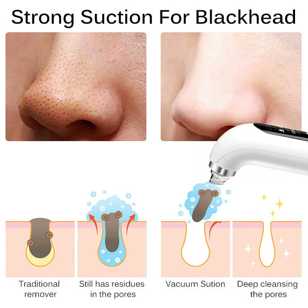 USB Rechargeable Blackhead Remover Tool