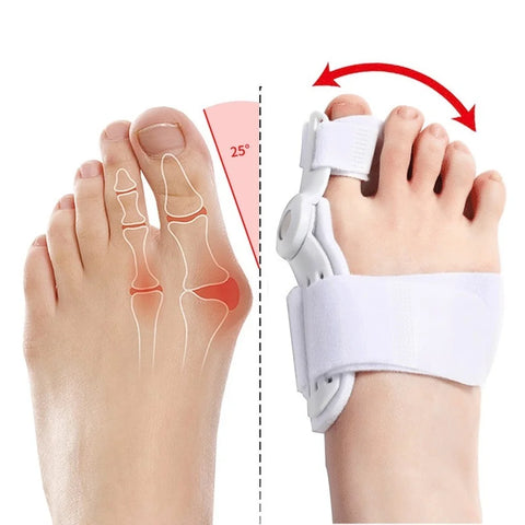 Big Bone Toe Bunion Foot Splint Corrector Tools